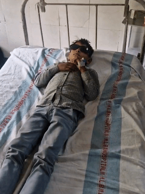 ऑपरेशन के बाद बच्चे की आंख पर काला चश्मा पहनाया गया है।