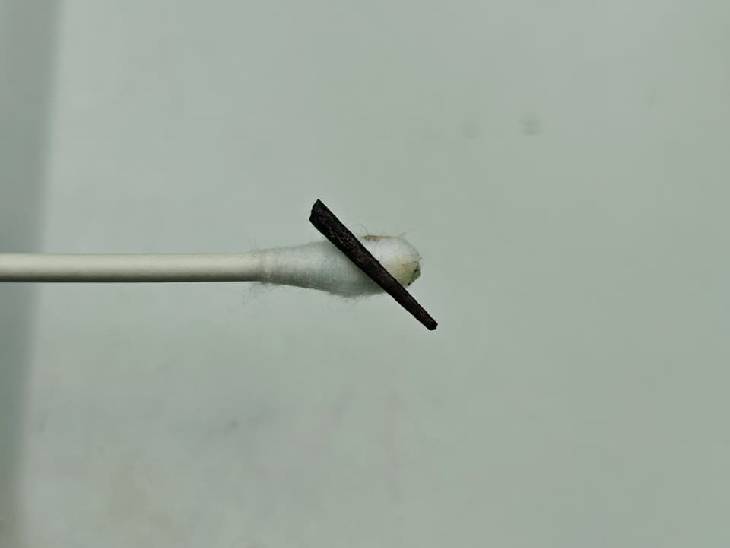 खजूर का कांटा बच्चे की पुतली को आर-पार कर गया था, जिसे सर्जरी के बाद निकाल दिया गया।