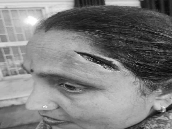 हमले में घायल अर्जुन की माता शमां।