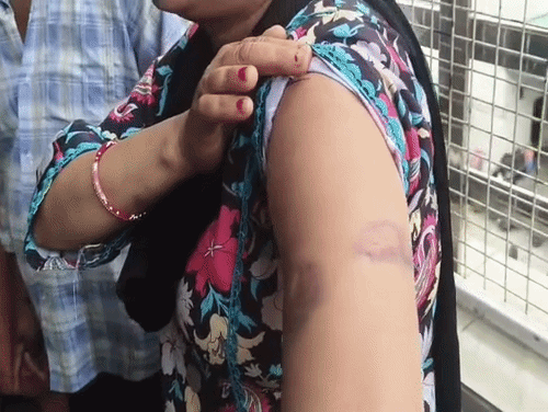 हमले में घायल अर्जुन की माता शमां।