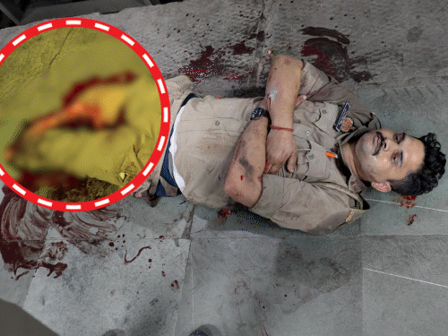 Gonda Cop Loses Leg Chasing Escapee | Train Accident