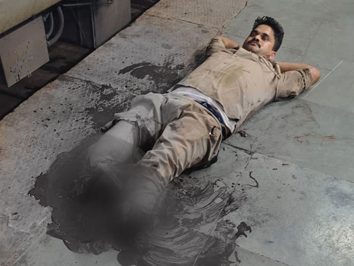 सिपाही के दोनों पैर कट गए। एक पैर कटकर अलग हो गया, जबकि दूसरा खाल के सहारे लटका है।