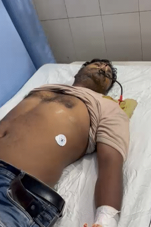 15 लोग बीमार है, जिनका अलग-अलग अस्पताल में इलाज चल रहा है।