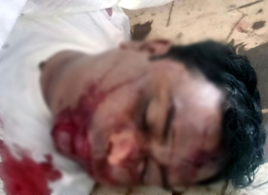 बदमाशों ने समीर खलीफा को निशाना बनाते हुए सामने से उसके सिर में एक गोली मार दी।