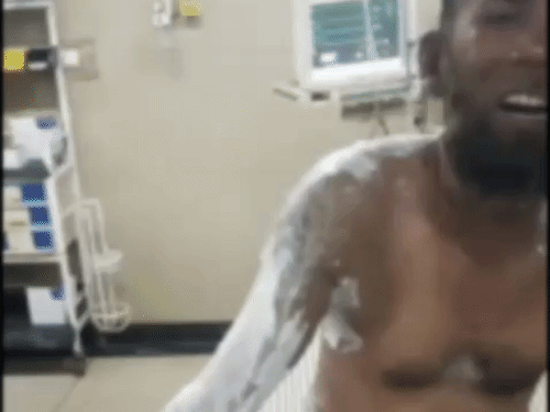 Meerut Arson Attack | Husband Severely Burnt in Wife Dispute