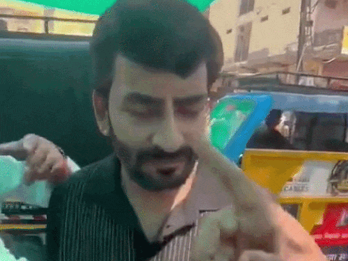 मारपीट के बाद चोट के निशान दिखाता हिसार का व्यापारी संजय।