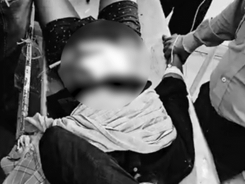 हमले के दौरान अरुण की पेट की अंतड़ियां बाहर आ गईं।