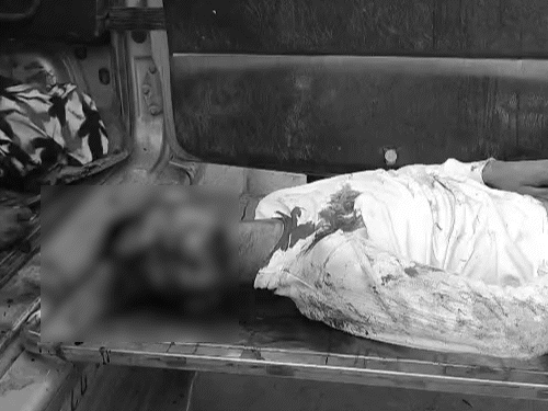 कोरबा में ट्रक से टक्कर के बाद युवक का सिर फट गया था।