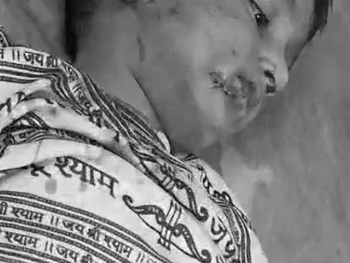 बच्चे के कान,गाल और होंठ पर कुत्ते ने काट लिया, बच्चा बुरी तरह जख्मी हो गया।