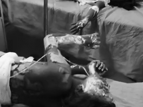 अस्पताल में तड़पते बच्चों का इलाज होता हुआ।