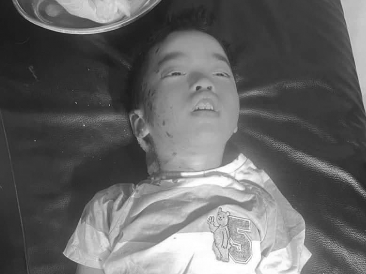 6 अप्रैल की आधी रात बम हमले में दोनों बच्चों की मौत हुई थी।