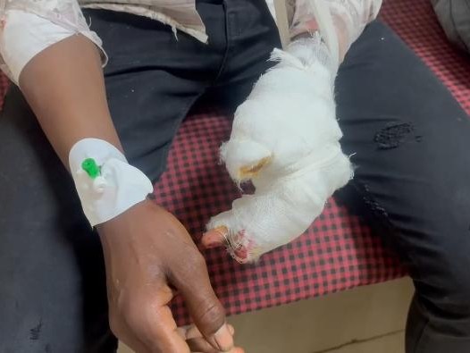 गन्ने रस की मशीन में फसा नाबालिग का हाथ बुरी तरह घायल - Dainik Bhaskar