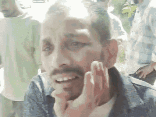 पुलिस के लाठीचार्ज में 20 कर्मचारी घायल हुए थे।