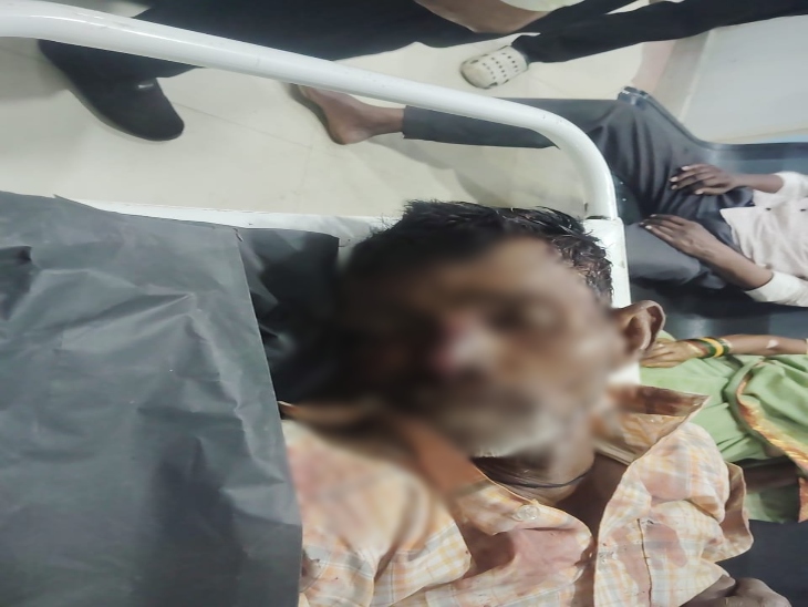 अकबर मोपेड से गिर गए थे, जब उन्हें अस्पताल लाया जा रहा था तो अज्ञात वाहन ने टक्कर मार दी।