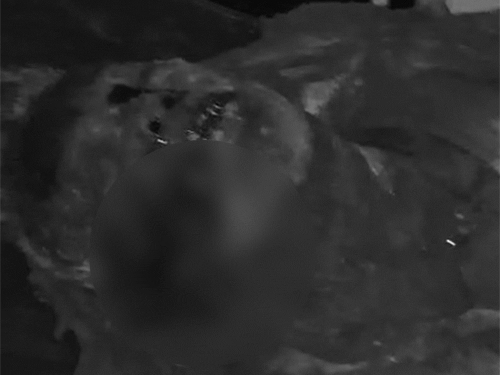 हादसे में मजदूर पूरी तरह झुलस गया है, पहचान जारी है।