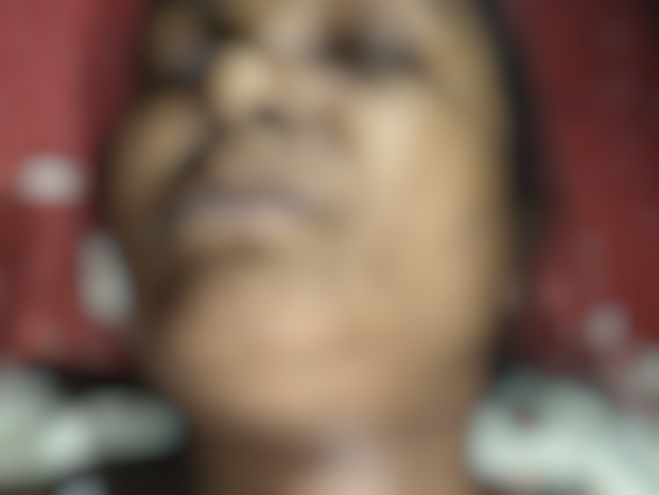 मृतका के भाई इफ्तार अंसारी ने आरोप लगाया कि उनकी बहन की हत्या उसके ससुर मौलाना शेखावत ने गला घोंटकर की है।