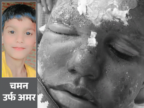 Lucknow Wedding Incident: Boy Thrown in Tandoor, Critically Injured