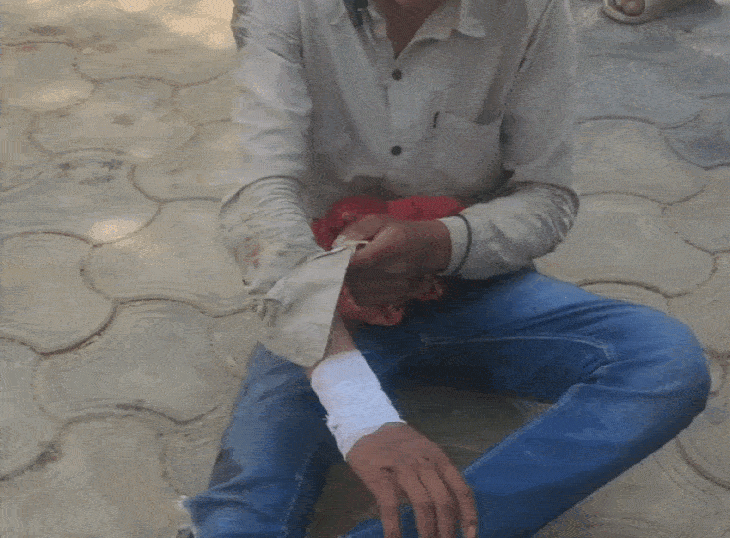 थार की टक्कर के बाद घायलों के हाथ पैर में चोट आई।