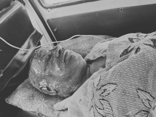 हत्या करने के दौरान रामवीर सिंह खुद ही गंभीर रूप से जल गया।