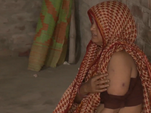 देसी बम हमले से एक महिला भी घायल हुई है।