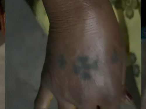 दुल्हन की मां और भाई के हाथ और पैर में चोट आई है।