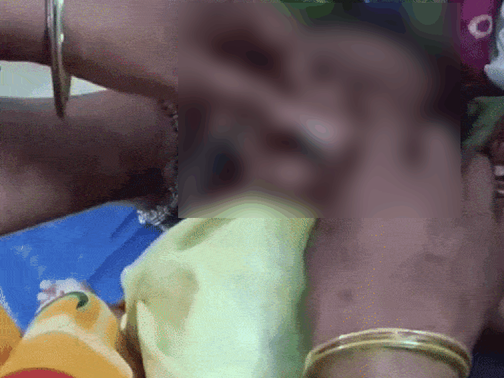 मासूम की नांक में लगाई जा रही नली।