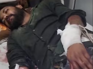 दिल्ली में मिक्सर-ग्राइंडर से हलवाई के हाथ काटने की कोशिश:  शादी के बकाया पैसे मांगने पर विवाद; छत पर बांधकर पीटा; दो नाबालिग भी गिरफ्तार