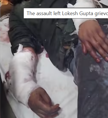 लोकेश के दोनों हाथों को काटने की कोशिश की गई।