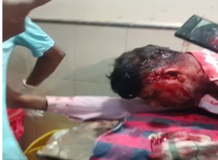 घटना के बाद अस्पताल में इलाज कराता हुआ पीड़िता।