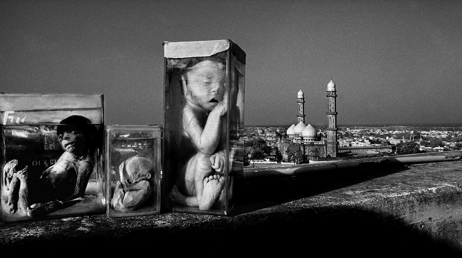 1984 में गैस त्रासदी में एबोर्टेड फीटस।