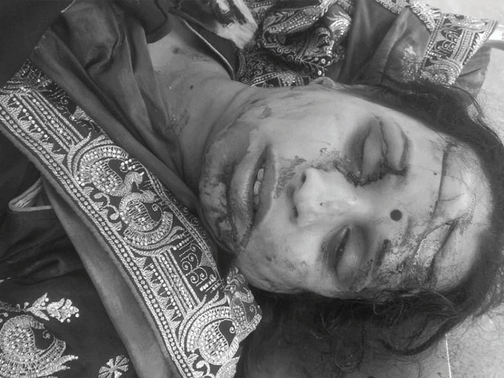 Bilaspur Road Accidents: 4 Dead, 29 Injured in Multiple Collisions