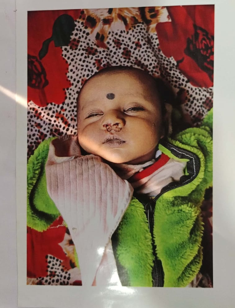 आरोपी शादीशुदा था, उसने दूसरी शादी की थी और बच्चा नहीं चाहता था।