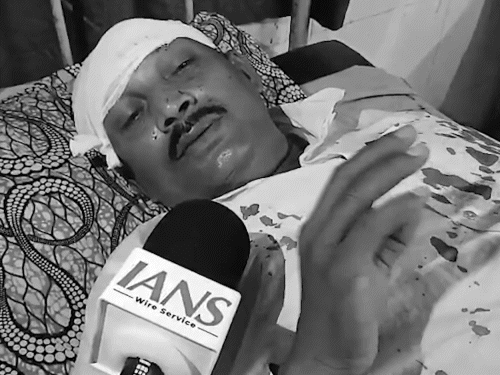 BJP कार्यकर्ता मोशर्रफ मीर ने आरोप लगाया कि चापड़ा के बूथ के बाहर TMC कार्यकर्ताओं ने उन पर हमला किया।