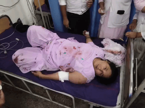 कार की टक्कर से ऑटो पलटने से घायल महिला अस्पताल में उपचाराधीन। - Dainik Bhaskar