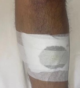 सिरसा में पड़ोसियों ने घर में घुसकर किया हमला:  बहस के बीच तलवार और कापा से वार; महिला, पति व देवर लहूलुहान – Sirsa News