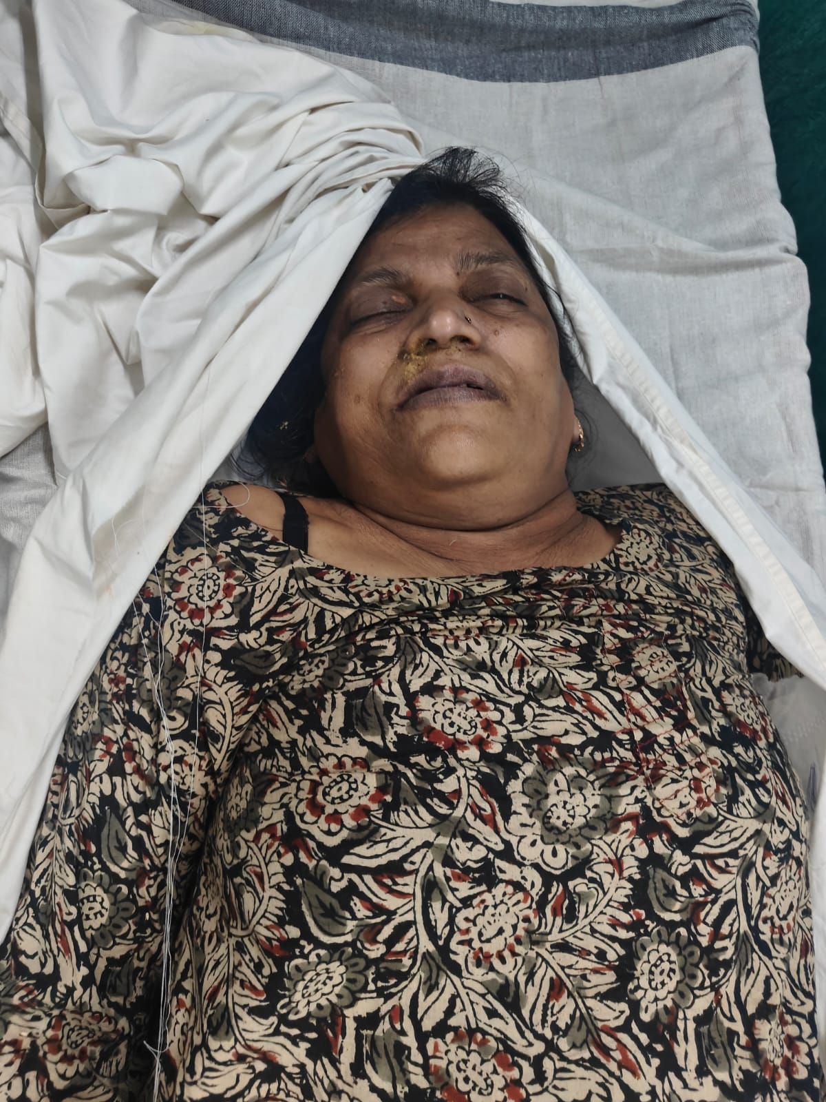 दिल्ली कैंट की रहने वाली मधुर (65) पति जूलियस की भी मौत हो गई।