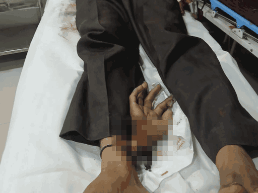 पंजाब-चंडीगढ़ अपडेट्स:  अटारी बॉर्डर पर रिट्रीट सेरेमनी का समय बदला; लुधियाना में पिकअप पलटी, ड्राइवर का हाथ कटा – Mohali News