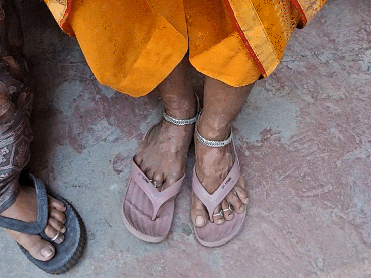 इस तरह पैरों पर खुजली हो रही है पानी से।