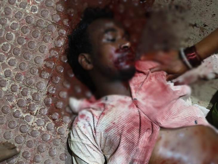 Bilaspur Attack: Father-Son Critically Injured; Accused Attacked With ...
