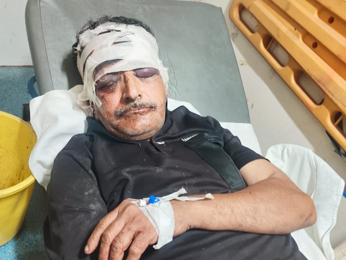 Kaithal Accident: Man Critically Injured After Hit by Unknown Vehicle