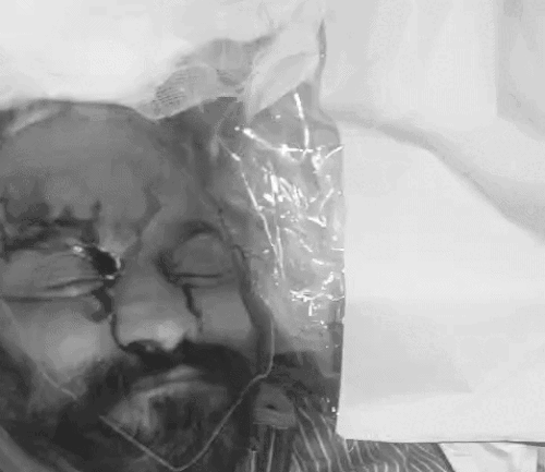 प्रॉपर्टी डीलर रिंपी अनेजा के चेहरे से खून भी बह रहा था।