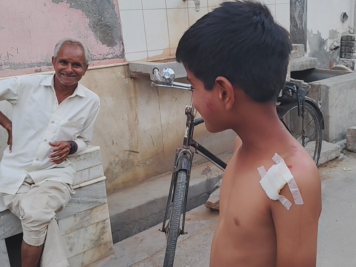बच्चे लक्की को खच्चर ने काट लिया।