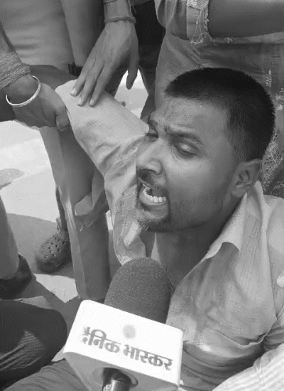 पुलिस के लाठीचार्ज में एक कैंडिडेट का सिर फट गया।