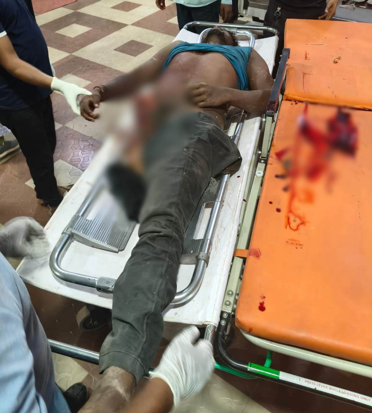 हादसे में एक युवक का पैर कट गया। इलाज जारी है।