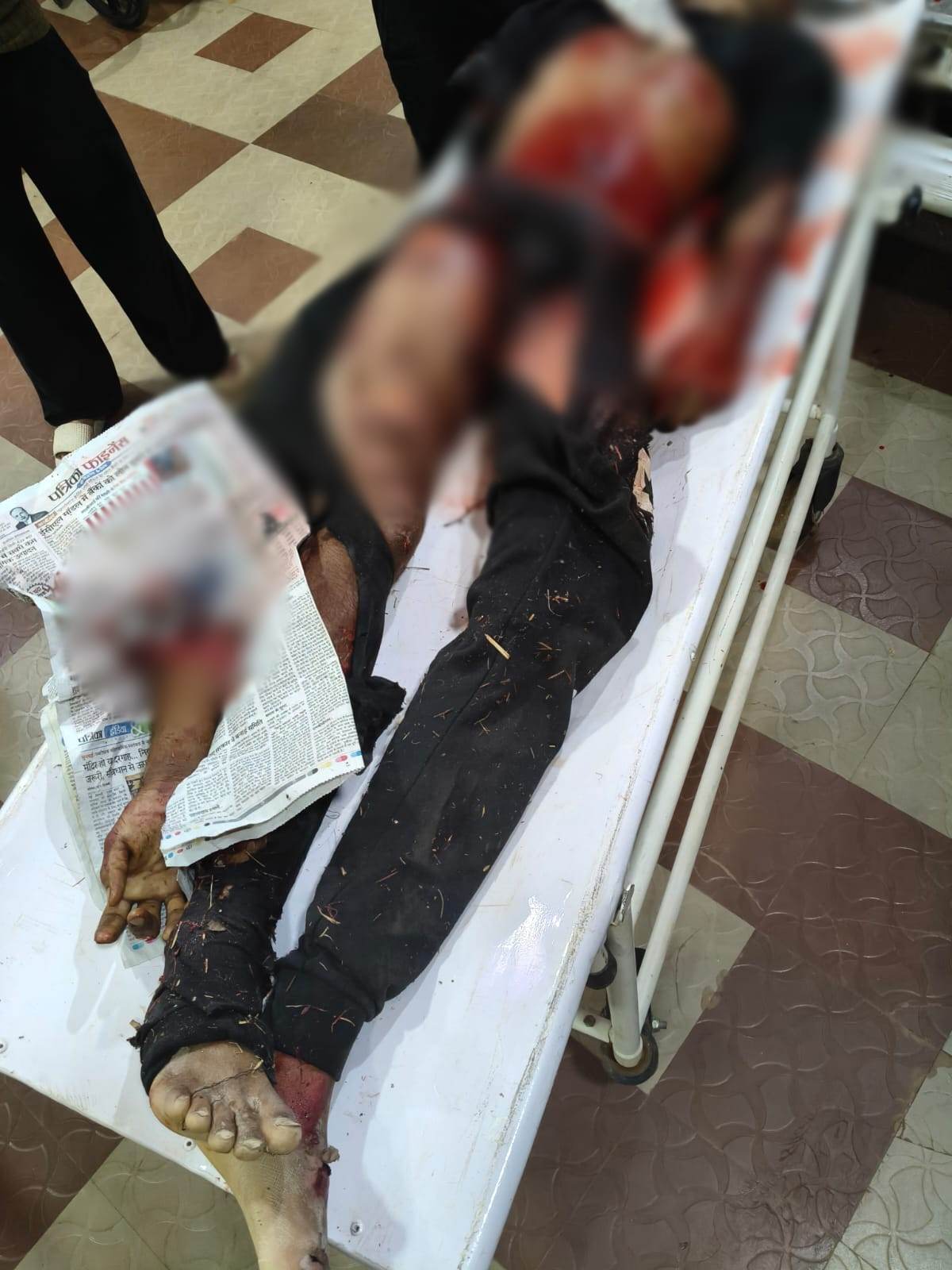 हादसे में दूसरे युवक का हाथ कटकर अलग हो गया।