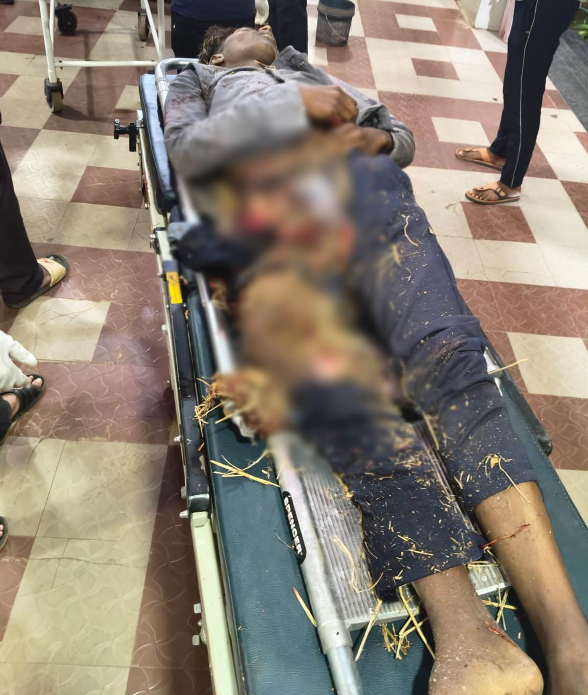 हादसे में तीसरे युवक का पैर टूट गया।