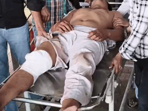 हादसे के तुरंत बाद घायल शिवकुमार को लोग सिविल अस्पताल लेकर पहुंचे।