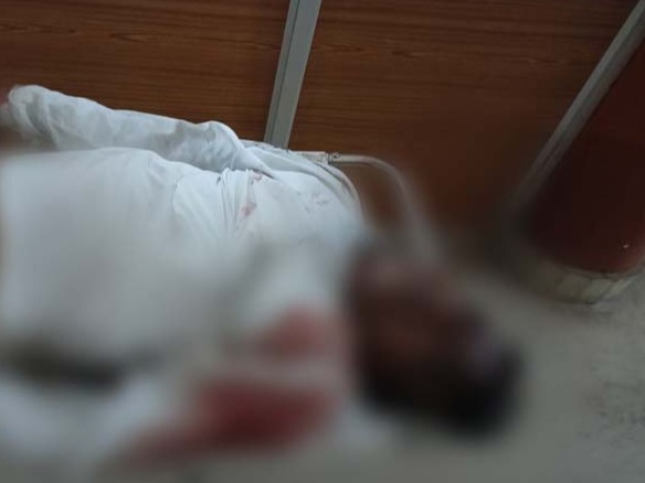 तेज रफ्तार कार का पेड़ से टकराने से ग्रामीण की मौत हो गई - Dainik Bhaskar