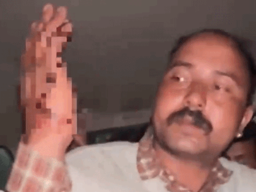 तलवार के हमले से एक स्थानीय का हाथ में कट लग गया और एक के गाल पर चोट आई।