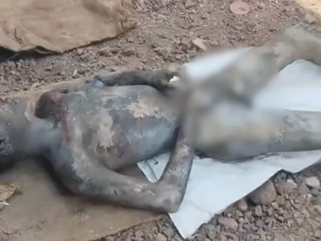 धमाके के बाद मजदूर बुरी तरह झुलस गए। कपड़े तक चमड़ी में चिपक गए।